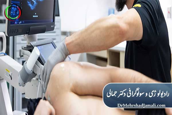 مراحل تهیه PRP