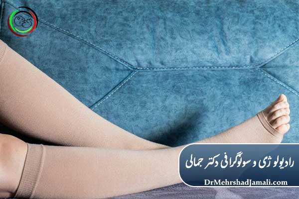  استفاده از جوراب واریس