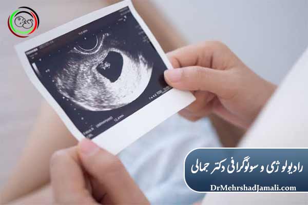 ویژگیهای شاخص مرکز ما در زمینه سونوگرافی جنین