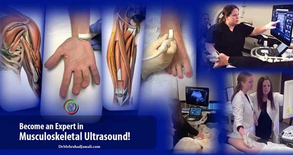 سونوگرافی MSK با MRI و CT