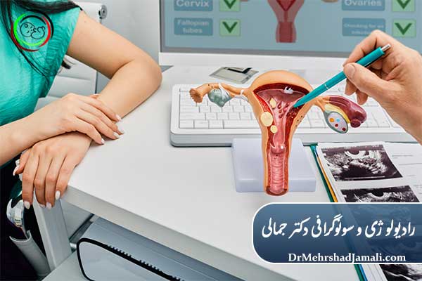 روش‌های تشخیص پولیپ و فیبروم