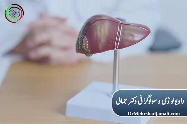 چرا کبد چرب را جدی بگیریم؟