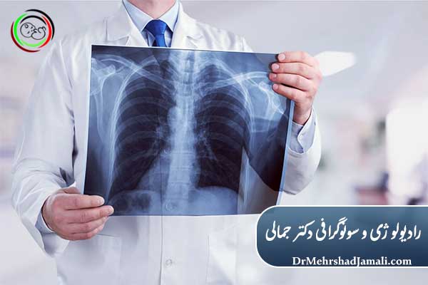 نکات مهم قبل از انجام Chest X-Ray  ( آمادگی های قبل از عکس قفسه سینه )