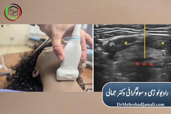سونوگرافی تخصصی سر و گردن در تهران