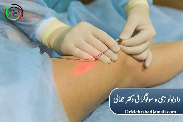 مراقبتهای بعد از لیزر واریس