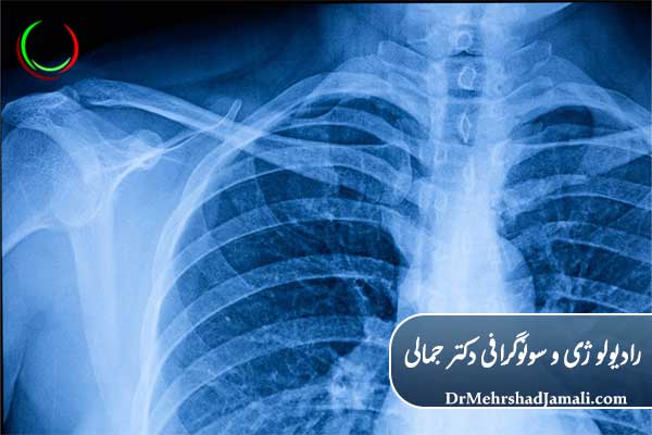 بررسی قفسه سینه با رادیولوژی