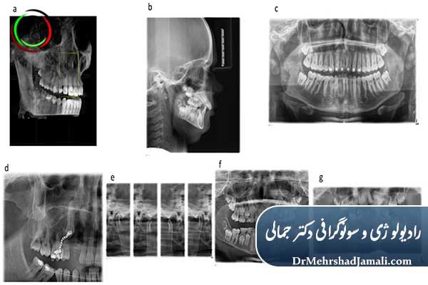 هر چند وقت یک‌بار باید عکس دندان گرفت؟