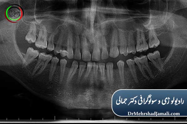 اهمیت رادیولوژی دندان در تشخیص و درمان