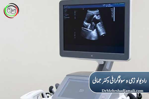 تشخیصی کلیدی  آپاندیسیت با سونوگرافی 