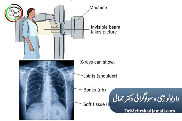 نحوه انجام رادیولوژی عمومی