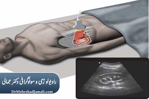 سونوگرافی کلیه ها