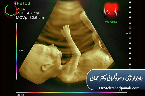اهمیت انجام اکو قلب جنین