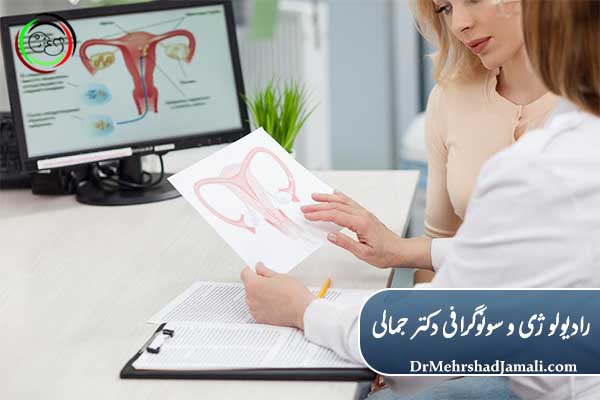 روش‌های تشخیص تنبلی تخمدان