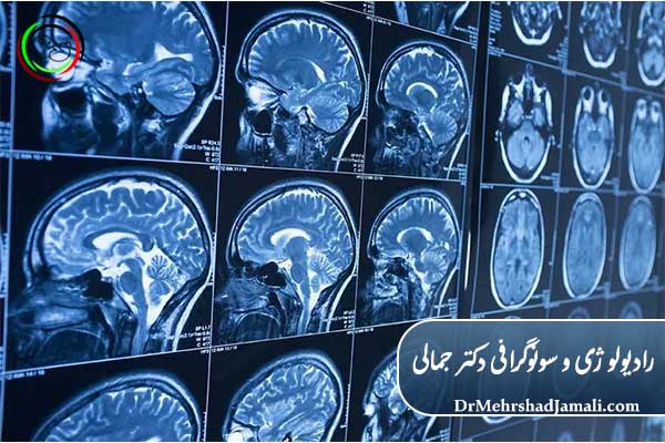 انواع روش‌های رادیولوژی