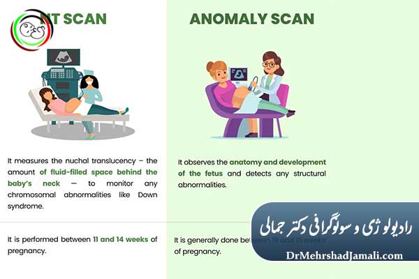 NT بهتر است یا آنومالی
