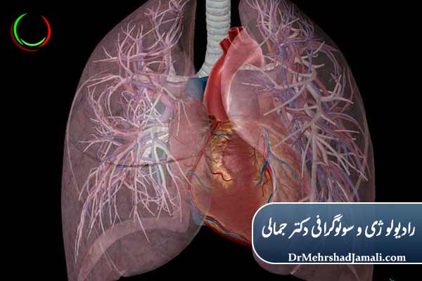چرا سونوگرافی و رادیولوژی در آمبولی ریه ضروری‌اند؟