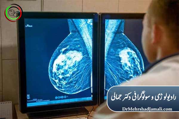 ماموگرافی دیجیتال در تهران 