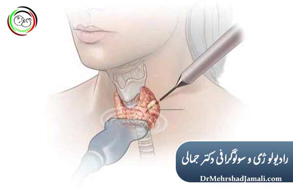 RF بهتر است یا مایکروویو؟