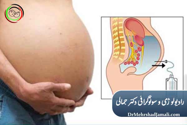 شایع‌ترین موارد 
