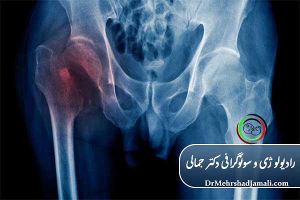 چه زمانی باید برای عکس رادیولوژی اقدام کنیم؟
