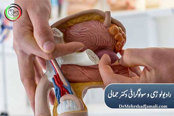 تفسیر جواب نمونه‌برداری پروستات