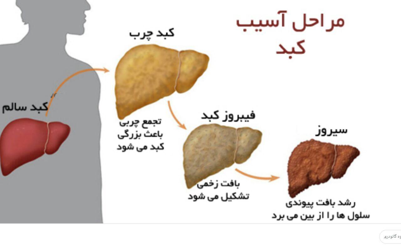 گرید کبد چرب خطرناک