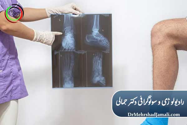 سونوگرافی یا رادیولوژی ،کدام روش برای شما بهتر است؟