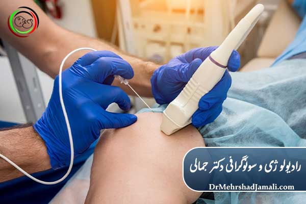  اسکلروتراپی واریس