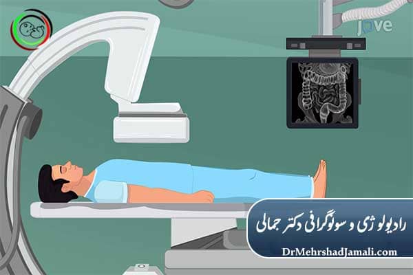 عکس رنگی روده چگونه انجام می‌شود؟