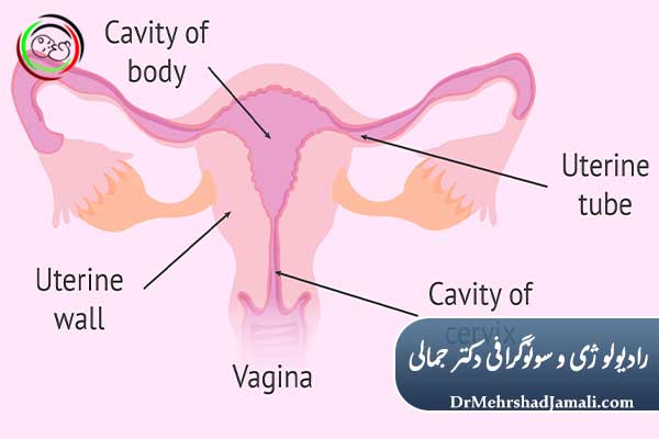 چگونه درد عکس رنگی رحم را کاهش دهیم؟