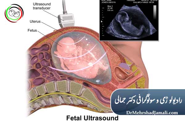 چگونه ضربان قلب جنین را بررسی می‌کنند؟