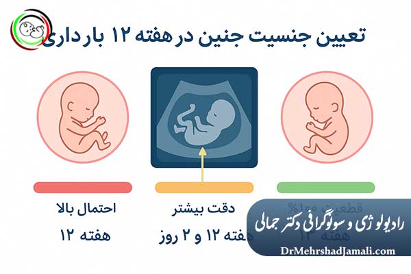  تعیین جنسیت در هفته ۱۲