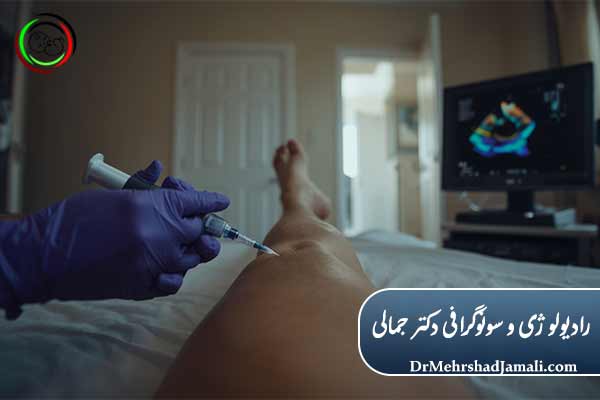 روش درمان واریس با تزریق تحت هدایت سونوگرافی در محل بیمار