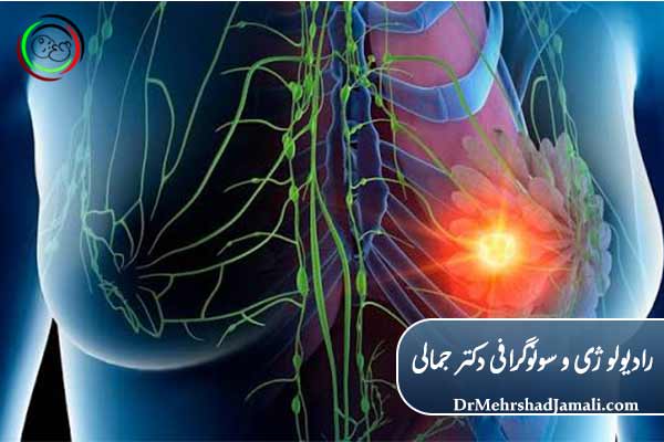 غربالگری سرطان سینه با ماموگرافی