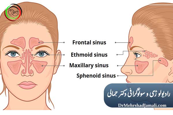هزینه عکس سینوس