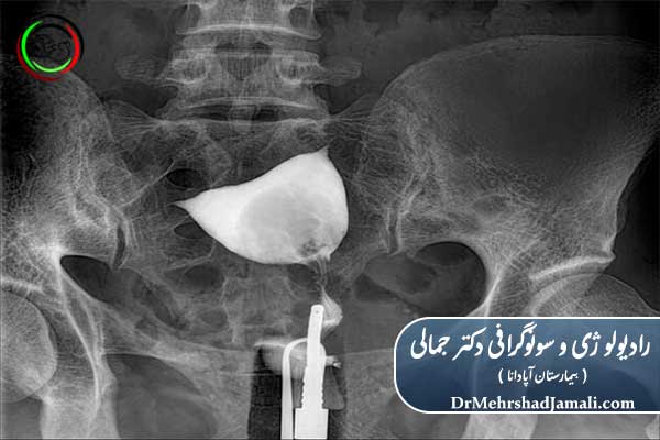 عکس رنگی رحم چیست؟