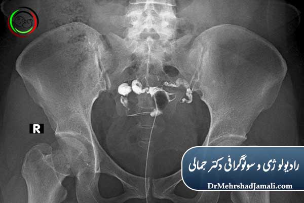 مراحل انجام عکس رنگی رحم (گام به گام)