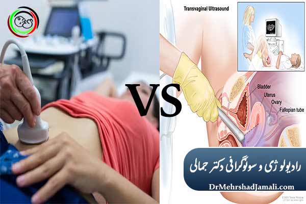 تفاوت سونوگرافی واژینال و شکمی 