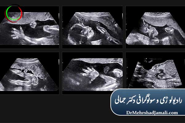 موارد قابل بررسی در آنومالی اسکن