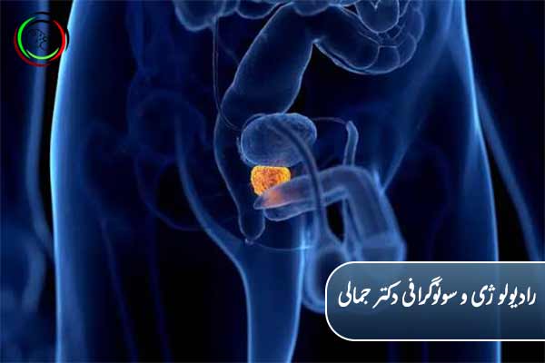 سونوگرافی پروستات