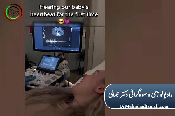 پایش ضربان قلب جنین