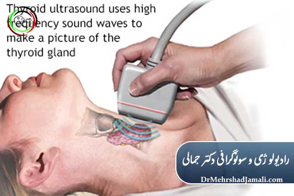 سونوگرافی تیروئید