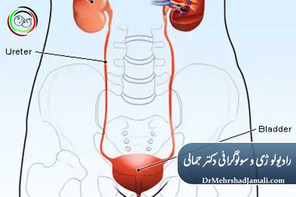 انجام VCUG در مرکز تصویربرداری دکتر مهرشاد جمالی