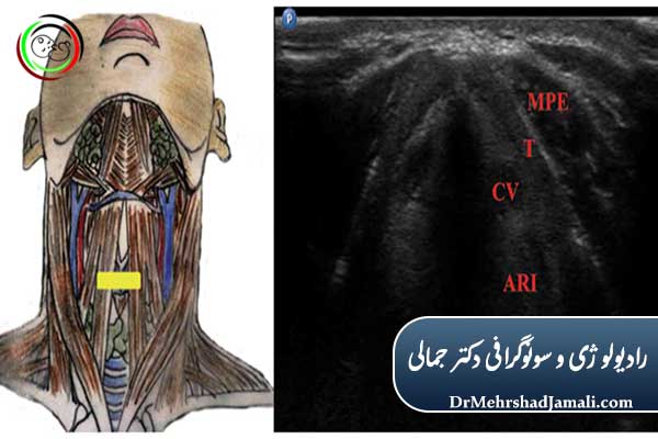 هزینه سونوگرافی گلو