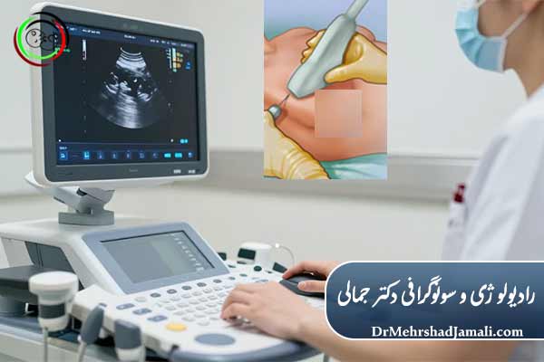 روش‌های نوین بیوپسی شکم