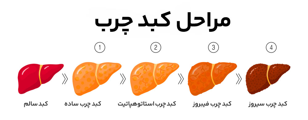 گرید کبد چرب خطرناک