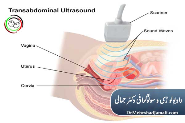 سونوگرافی شکمی چیست؟
