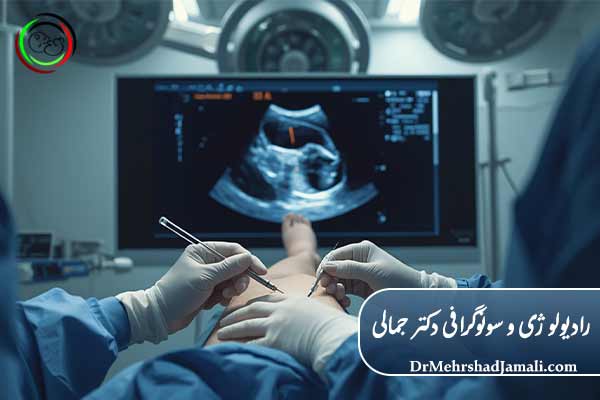 نقش طلایی سونوگرافی در تشخیص و درمان واریس