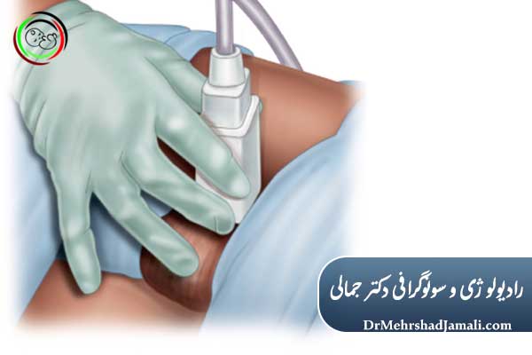 نحوه انجام سونوگرافی بیضه