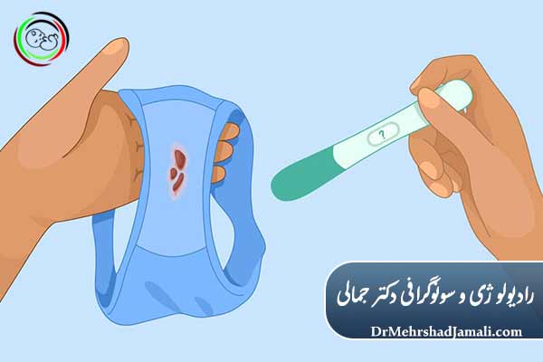 لکه‌بینی چیست؟